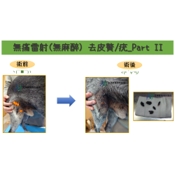 3/21 無痛雷射(無麻醉) 去皮贅/疣_Part II