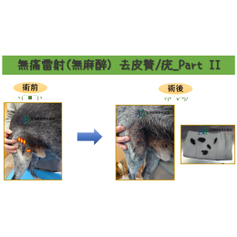 3/21 無痛雷射(無麻醉) 去皮贅/疣_Part II